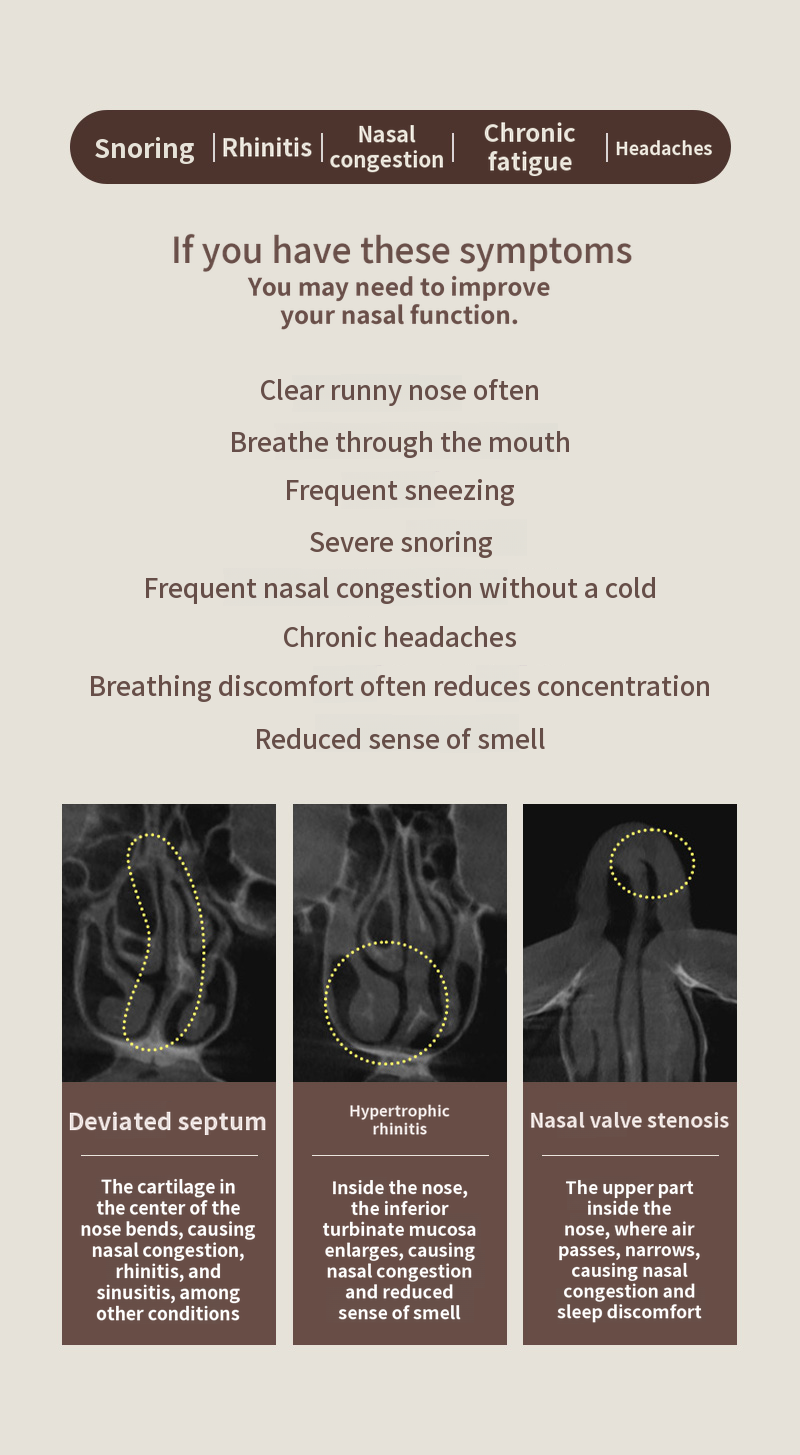 ❤️View❤️Functional Rhinoplasty