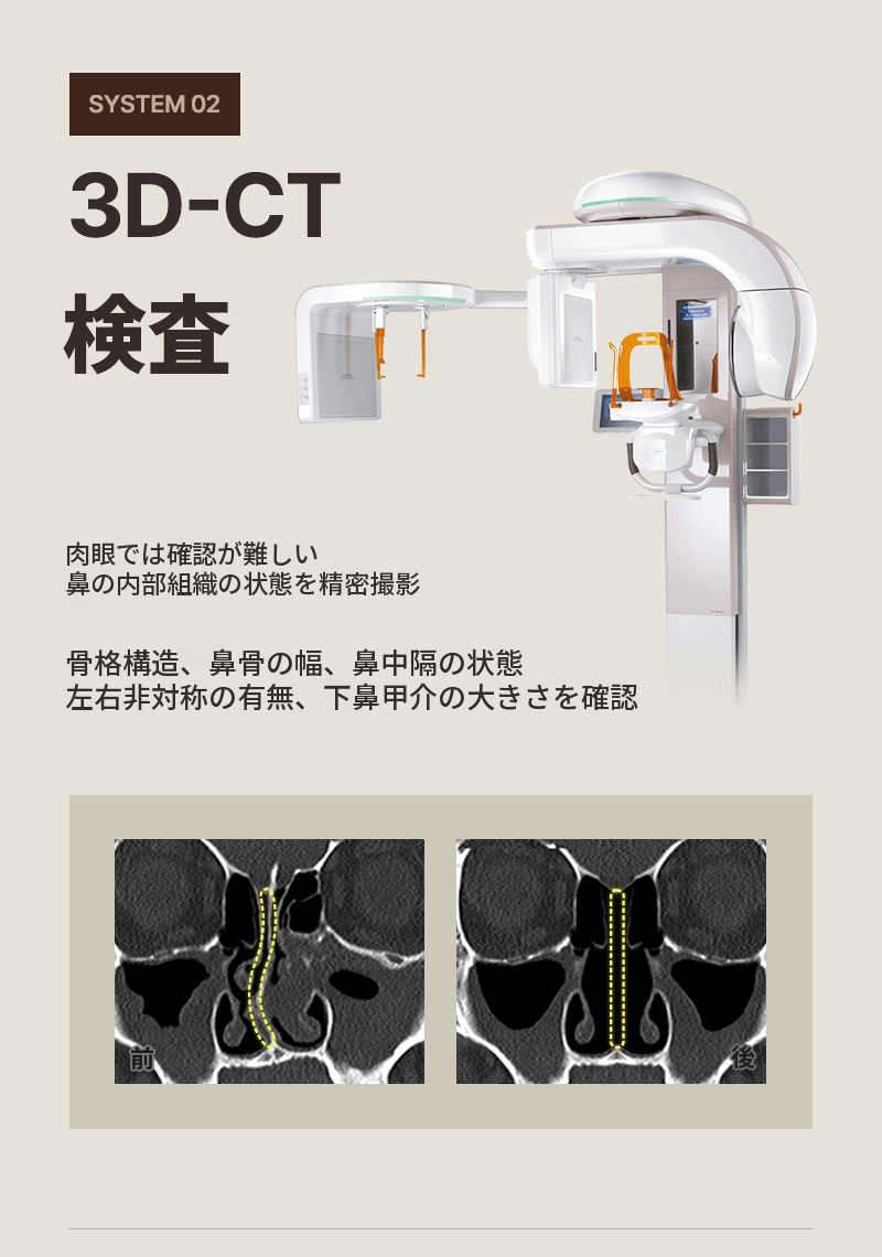 ❤️ビュー❤️機能性鼻整形