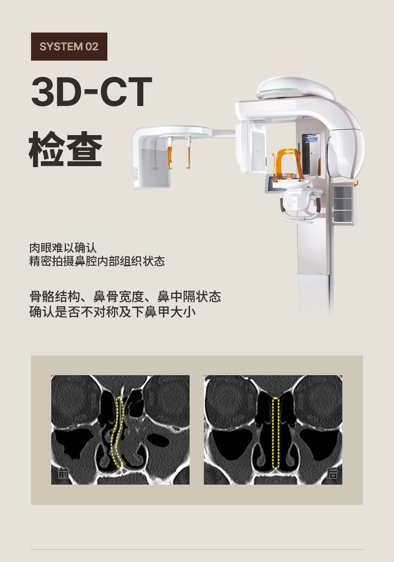 ❤️美观❤️功能性鼻整形
