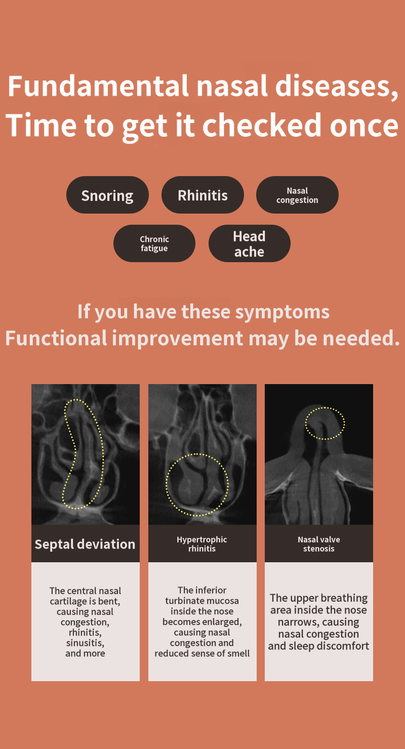 ❤️View❤️Functional Nose Surgery