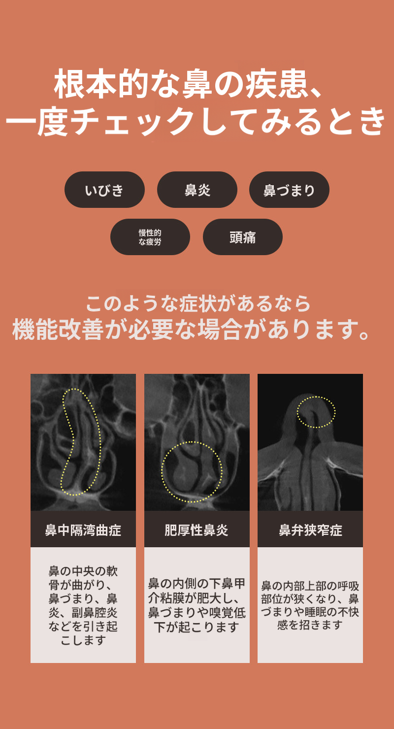 ❤️ビュー❤️機能コ成形