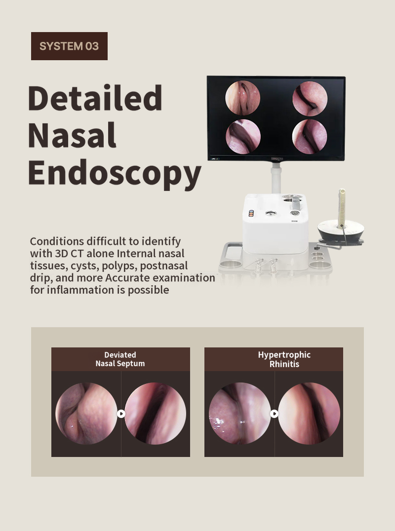 ❤️View❤️Functional Rhinoplasty