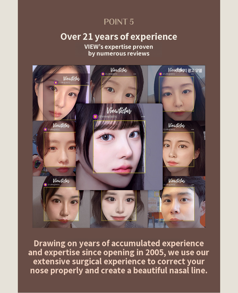 ❤️View❤️Functional Rhinoplasty