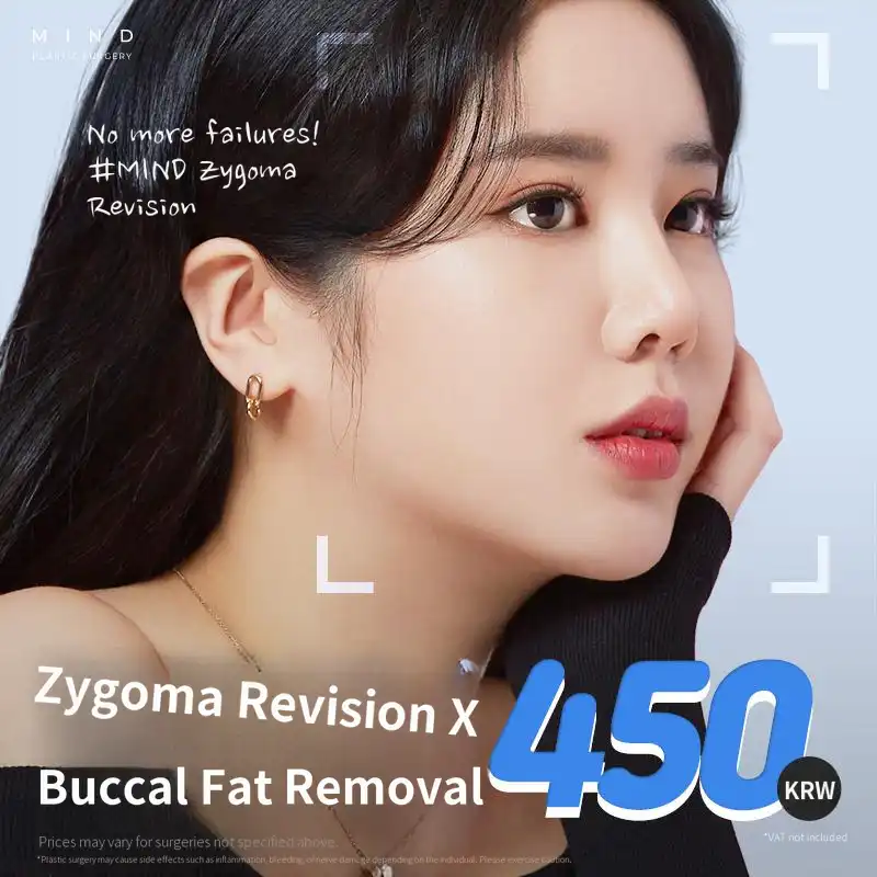 [Mind] Cheek Revision Surgery