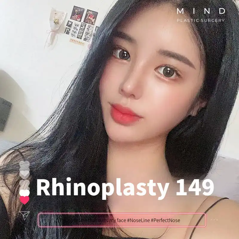 [Mind] Goddess Nose Surgery