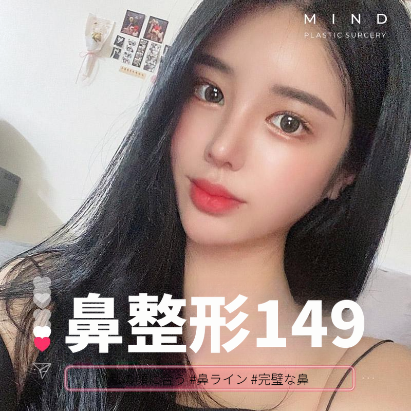[マインド] 女神の鼻整形