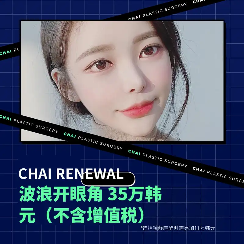差异波浪开眼 35万元♥