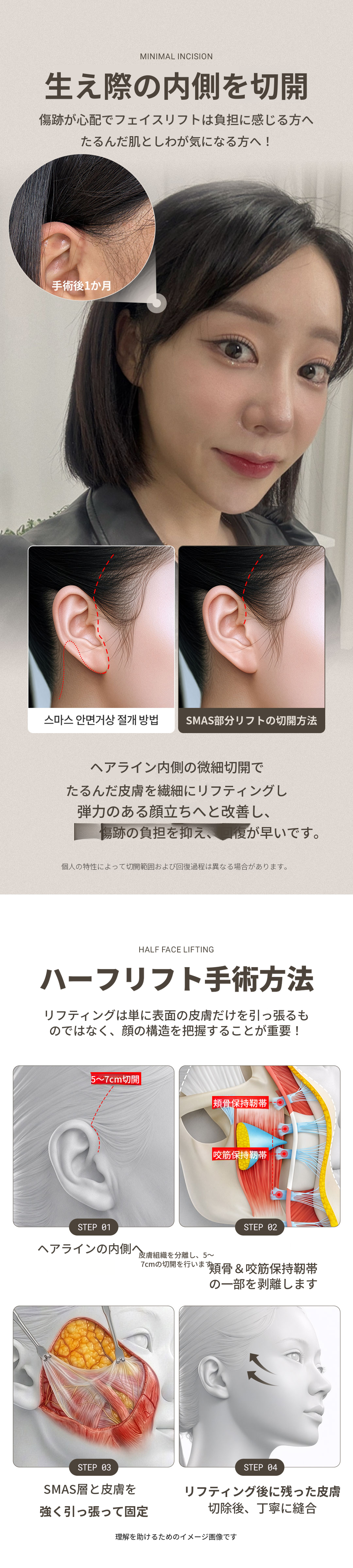 ♥DMスマスリフト♥