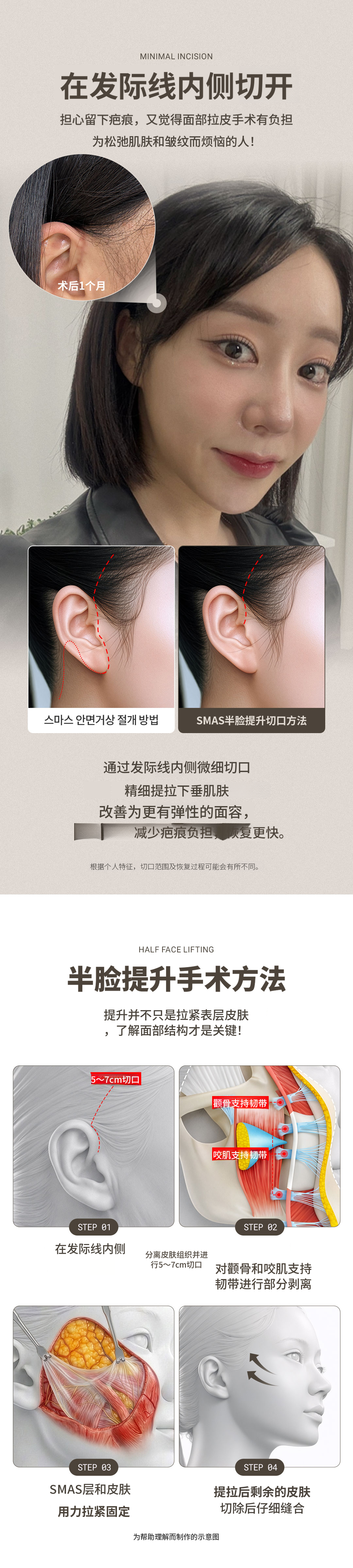 ♥迪爱美斯微吊脸♥