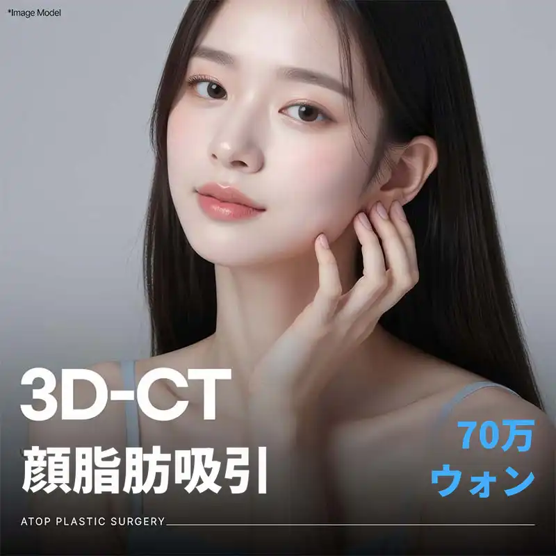 3D-CT顔脂肪吸引