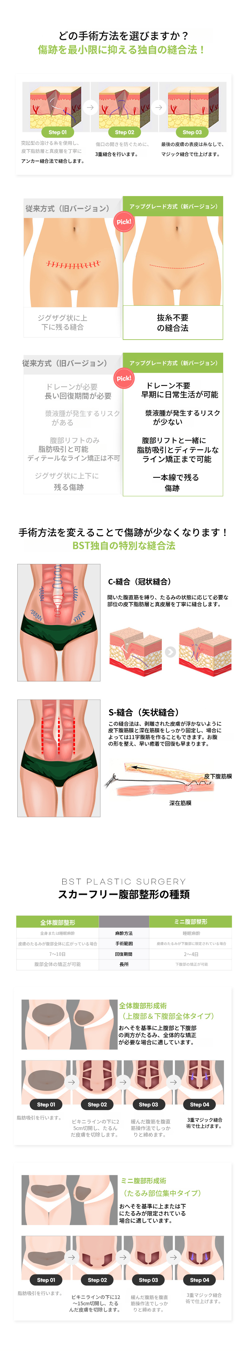 ❤️スカーフリミニ腹部形成❤️