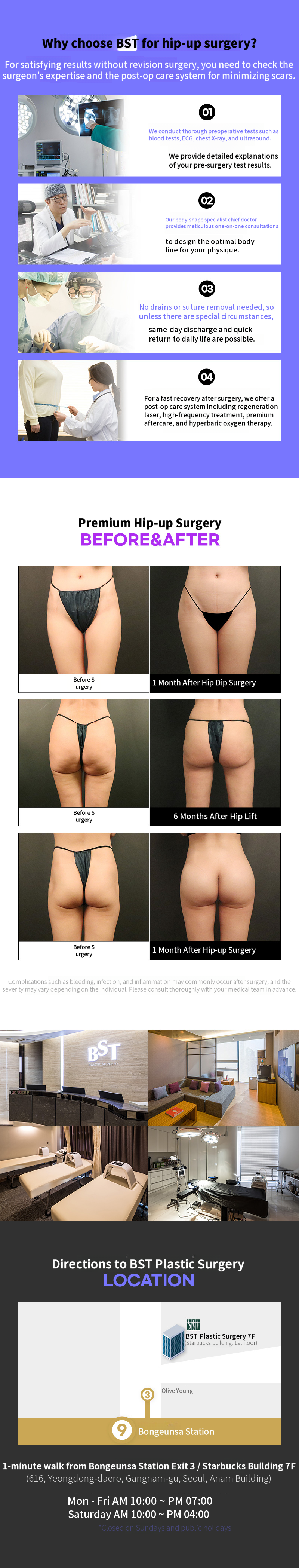 ❤️Hip Fat Grafting❤️