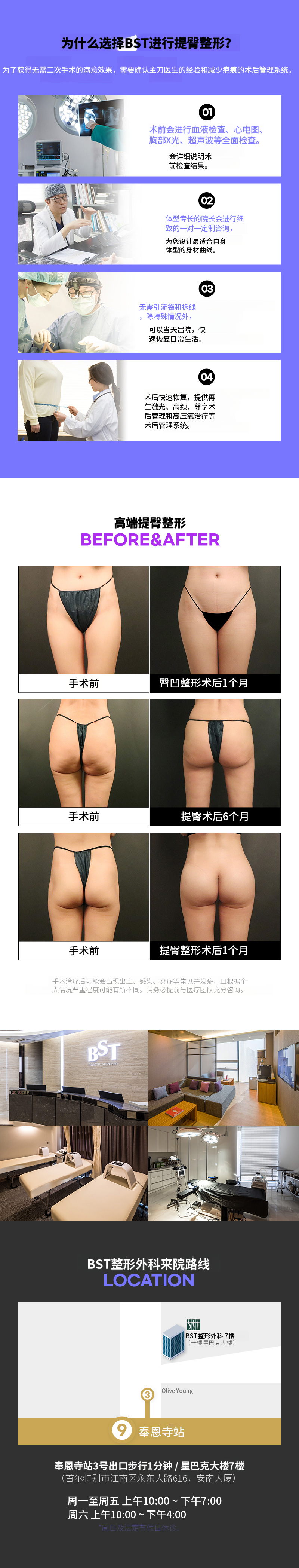 ❤️髋关节脂肪移植❤️