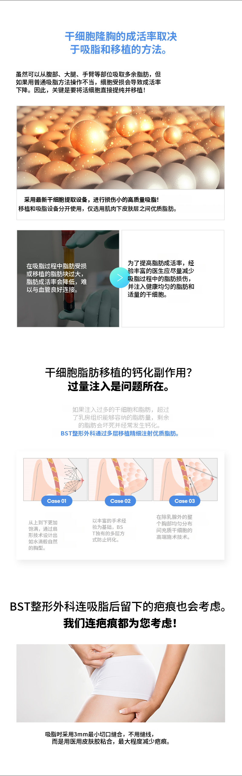 ❤️干细胞胸部整形❤️