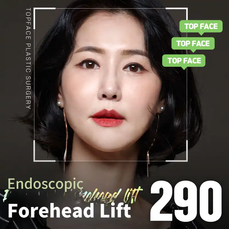Top Face Endoscopic Forehead Lift