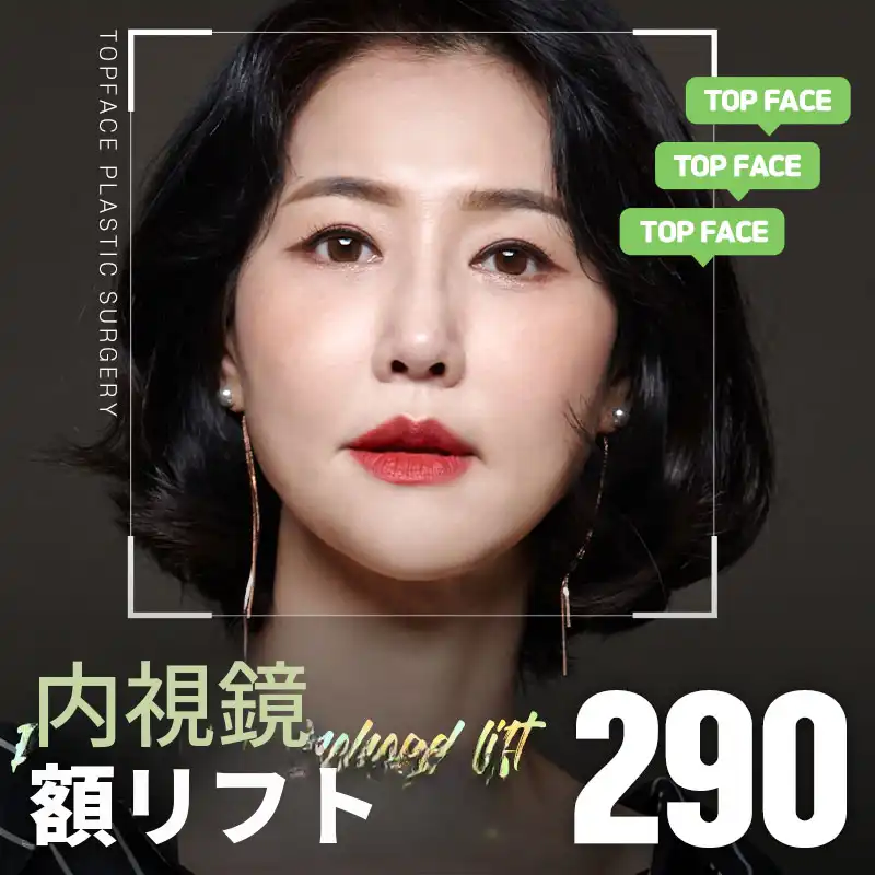 タップフェイス内視鏡おでこリフト術