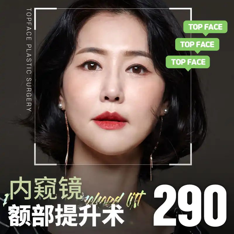 顶级面部内窥镜额头提升术