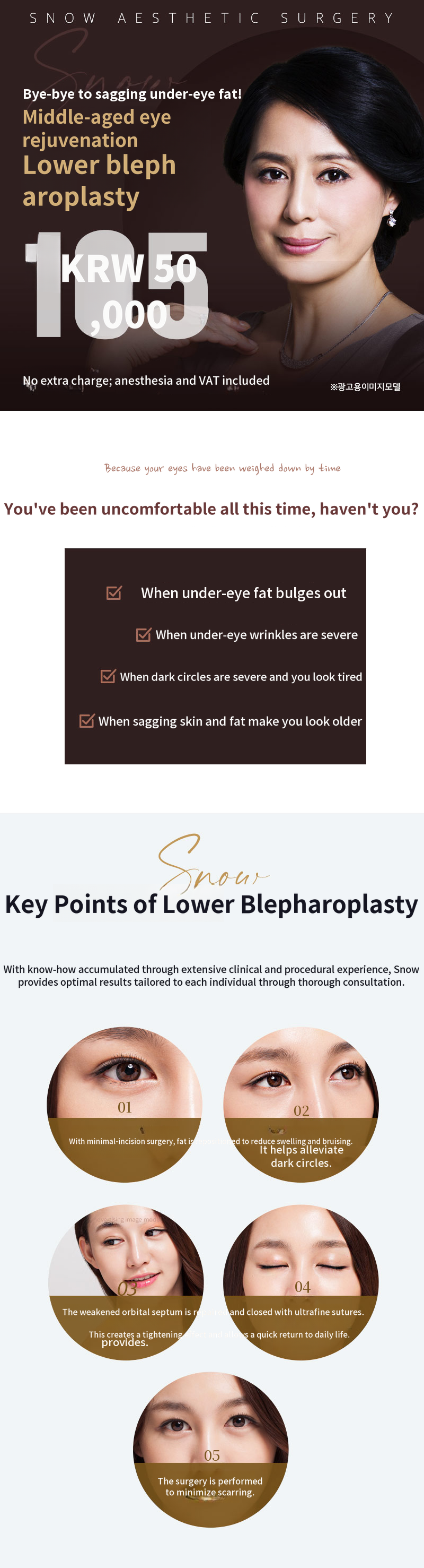 Midlife Eyelid Surgery (Lower Blepharoplasty)