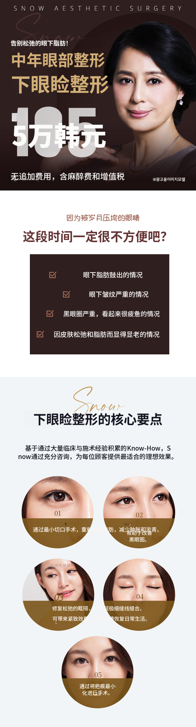 中年眼部整形下睑整形