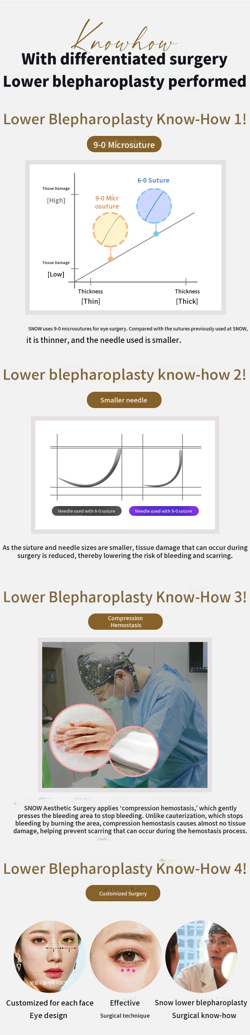 Midlife Eyelid Surgery (Lower Blepharoplasty)