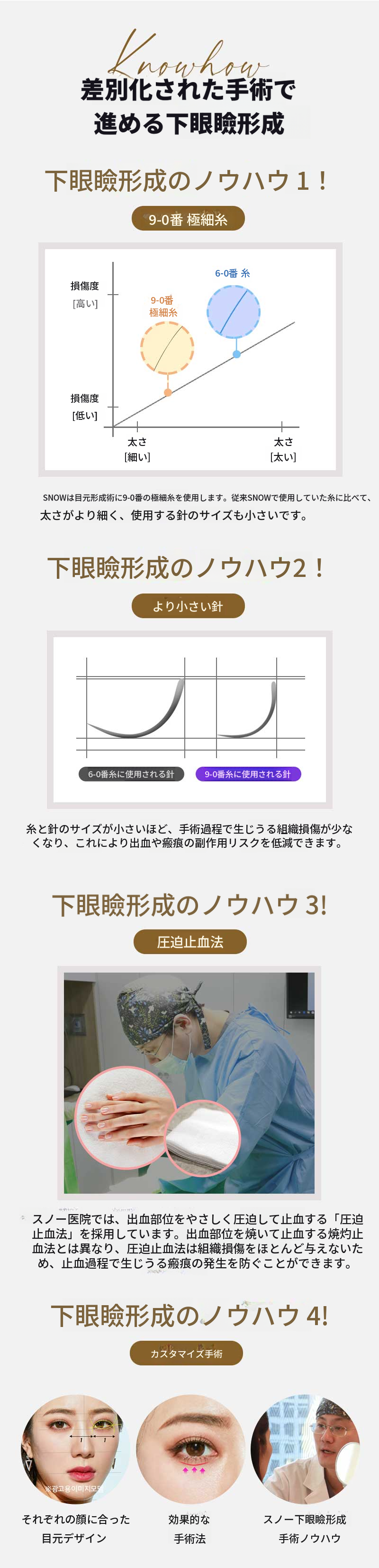 中年の目の整形　下まぶたの手術