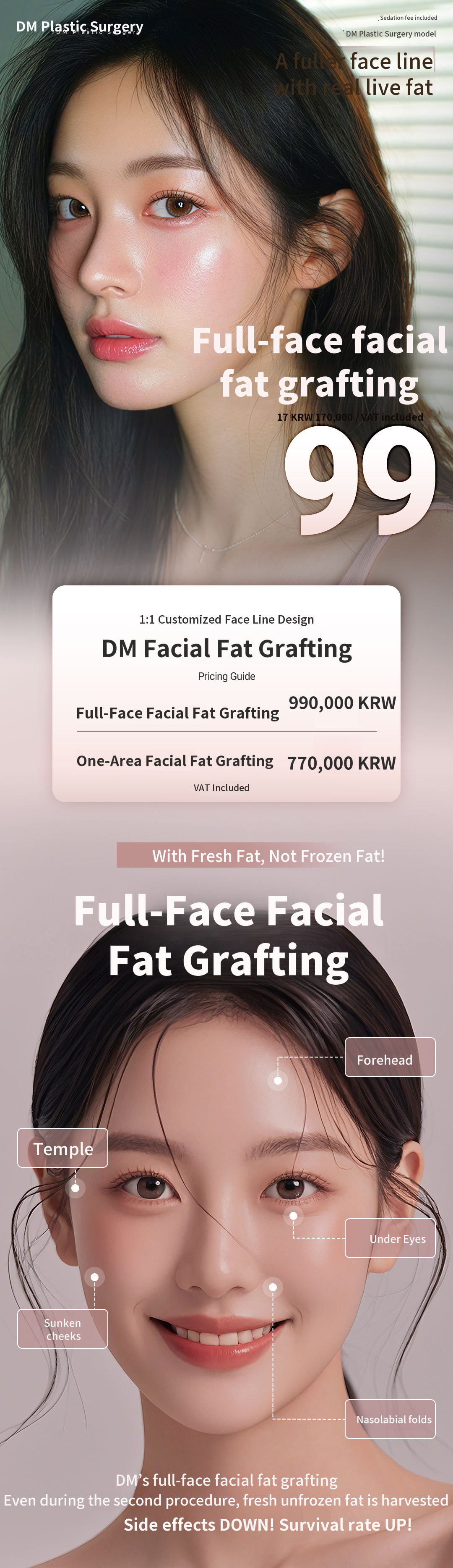 ★Full Face Fat Grafting★