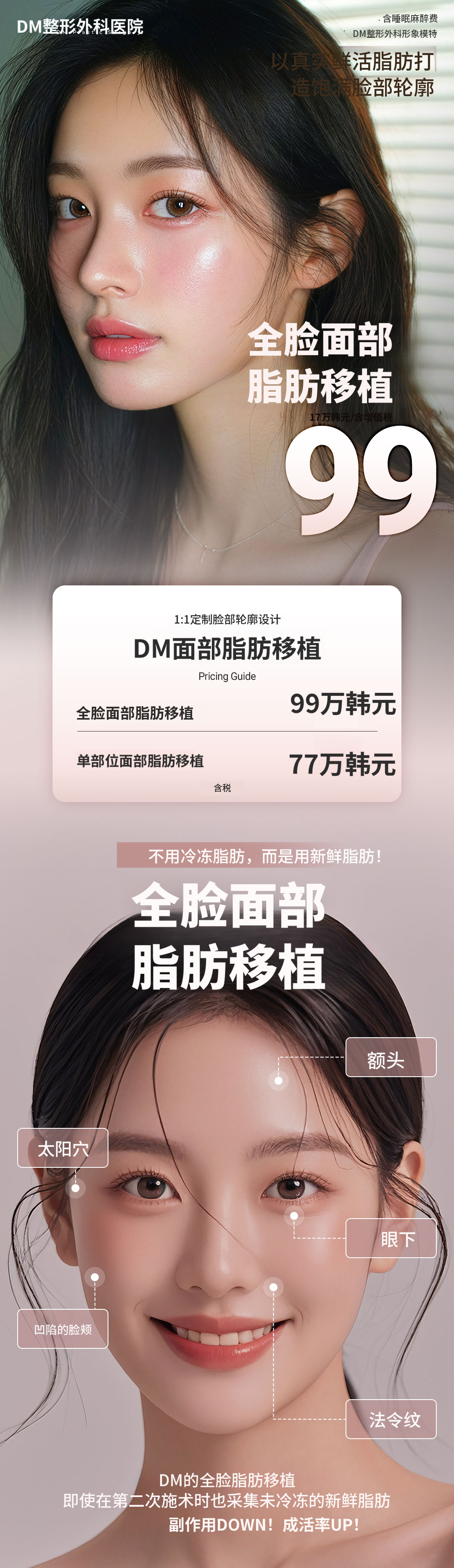 ★全脸脂肪移植★