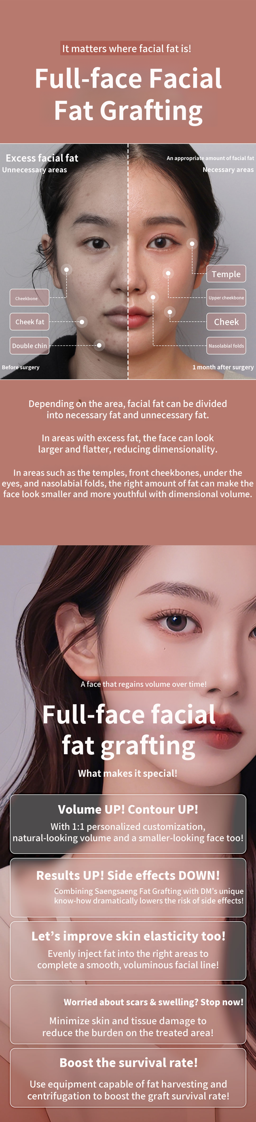 ★Full Face Fat Grafting★