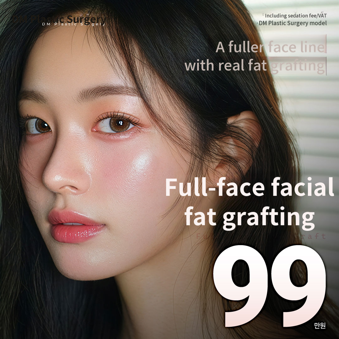 ★Full Face Fat Grafting★