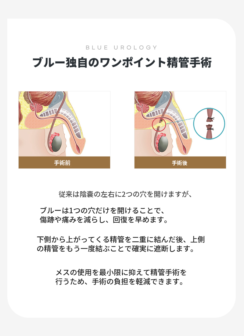 漢南ミサ) 無痛精管手術 EVENT！