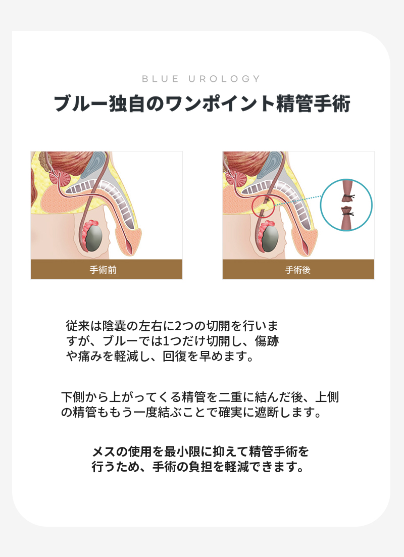 パンギョ) 無痛精管手術 イベント