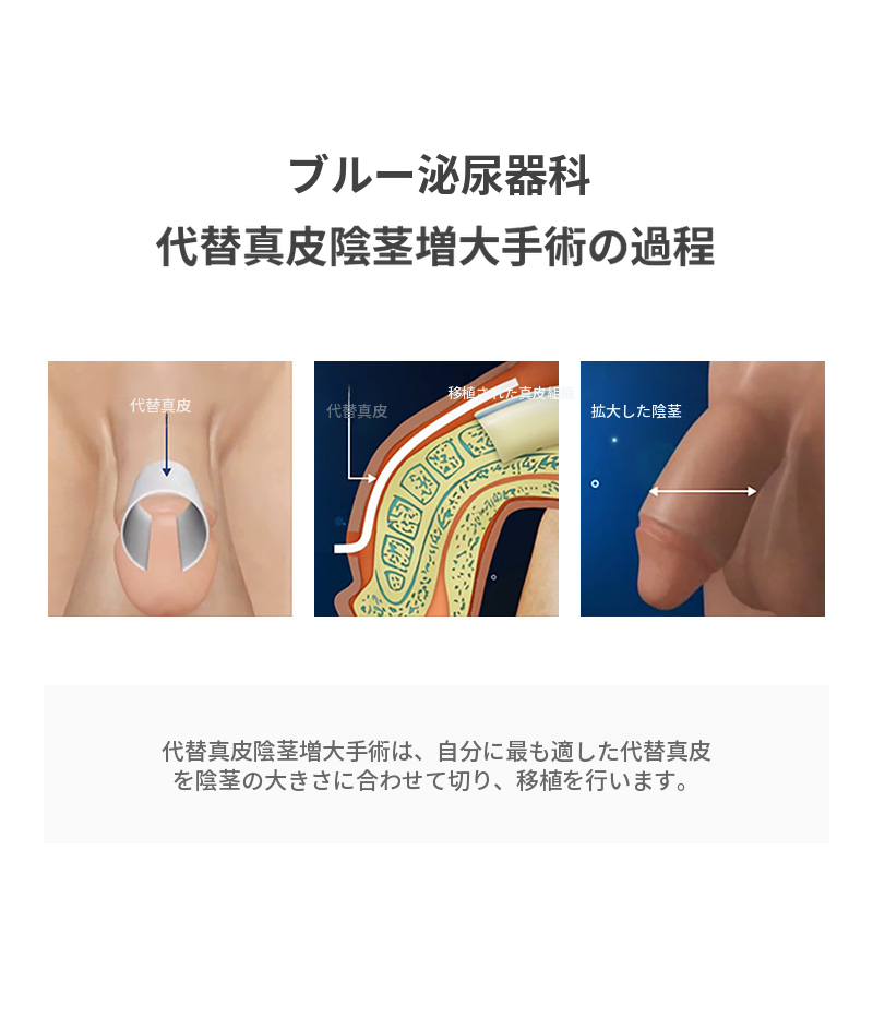 漢南ミサ) 代替真皮拡大手術 EVENT
