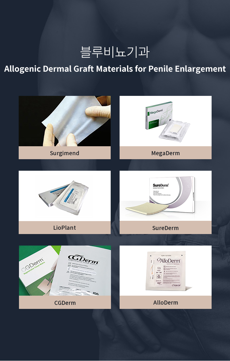Hanam Misa) Alternative dermis expansion surgery EVENT