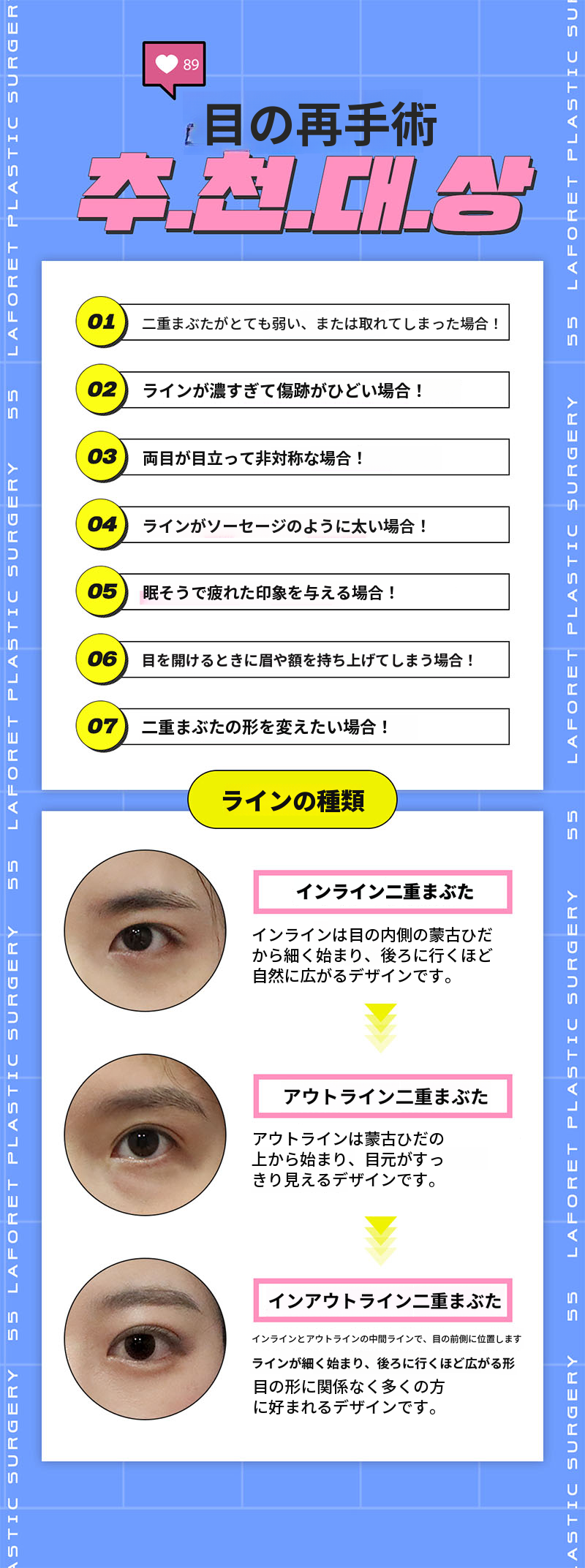 再眼手術