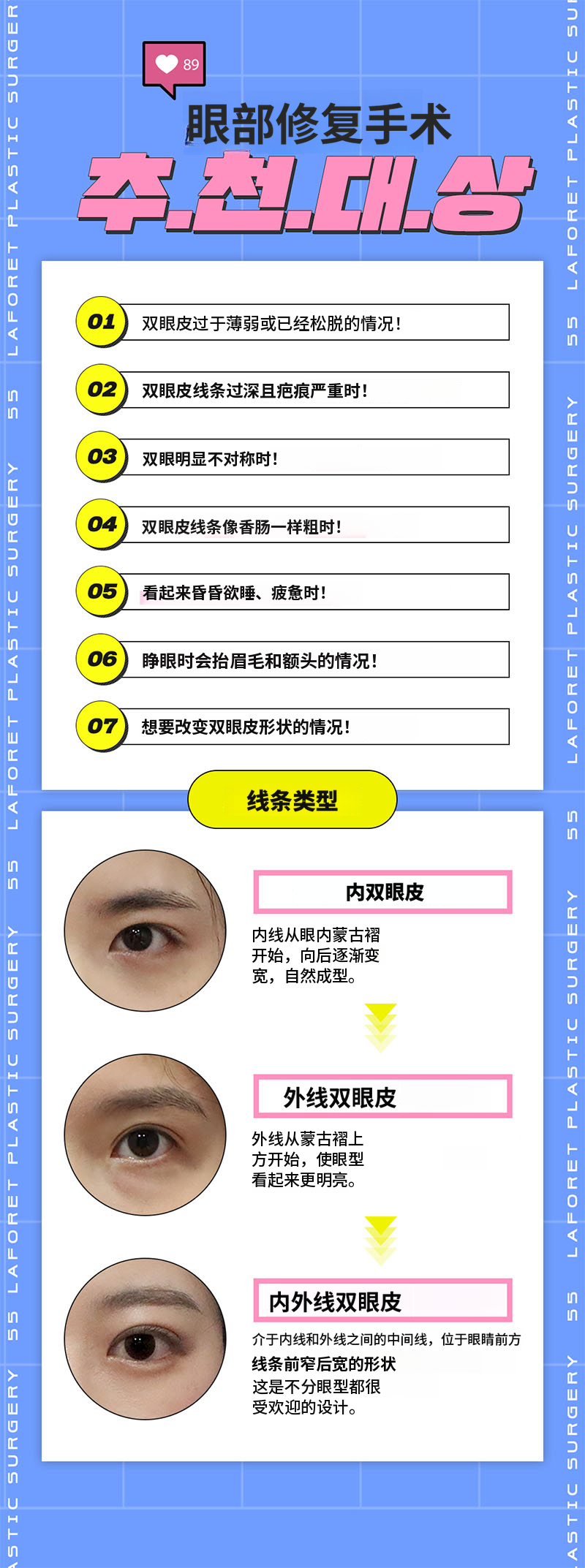 眼部再手术