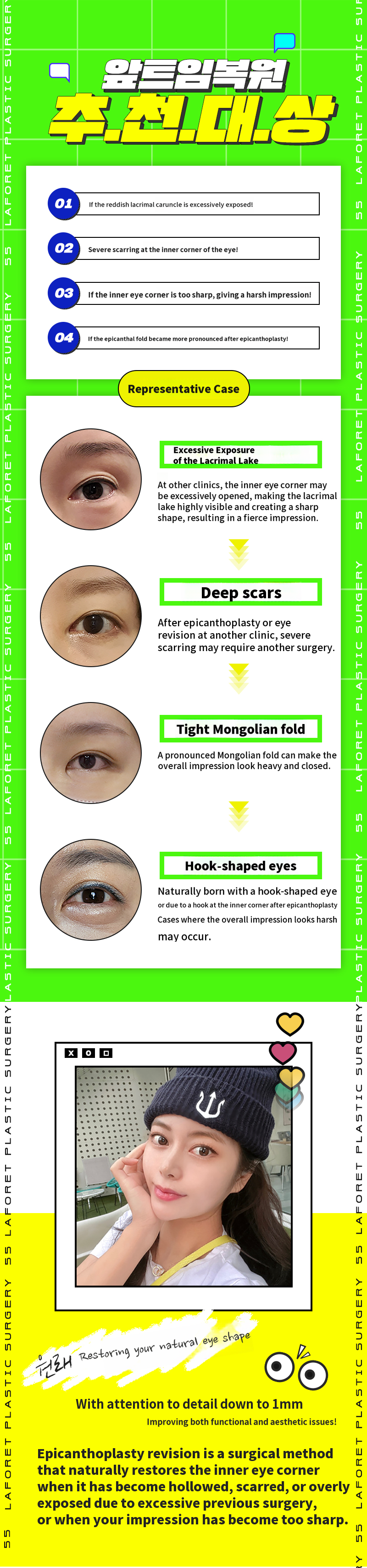 The difference of 1mm, front eye restoration