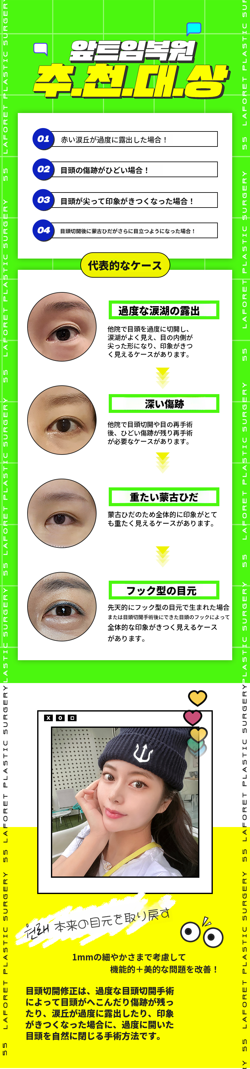 1mmの差、前切開復元
