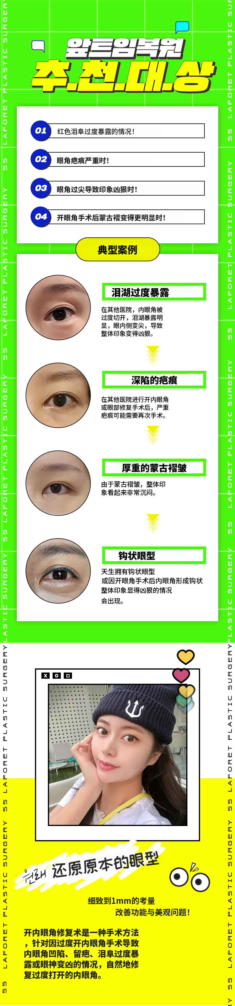 1mm的差距，前开眼角修复