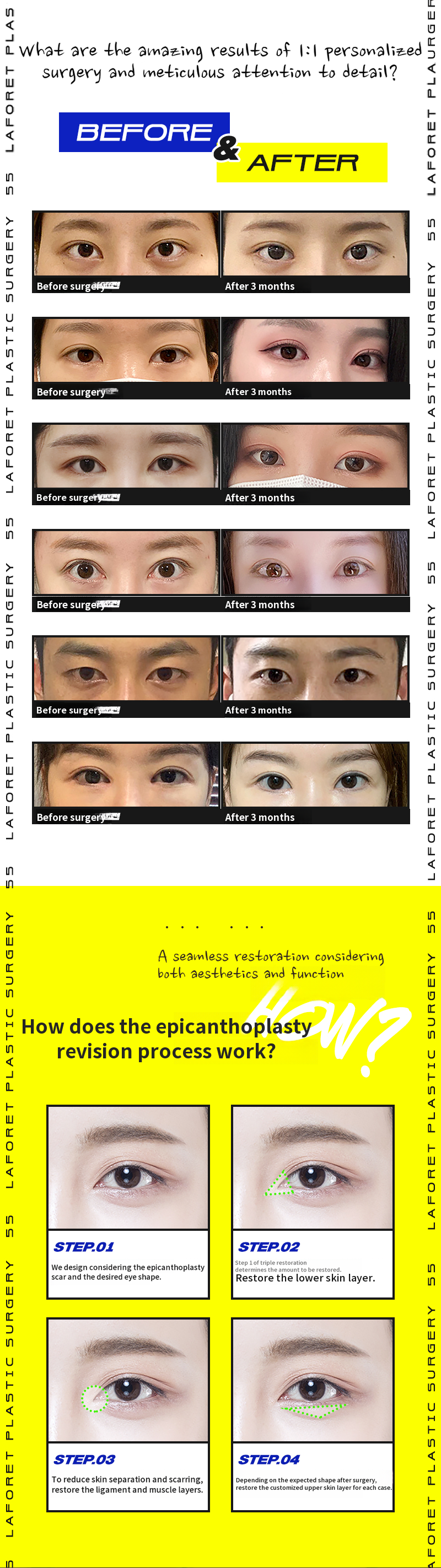 The difference of 1mm, front eye restoration