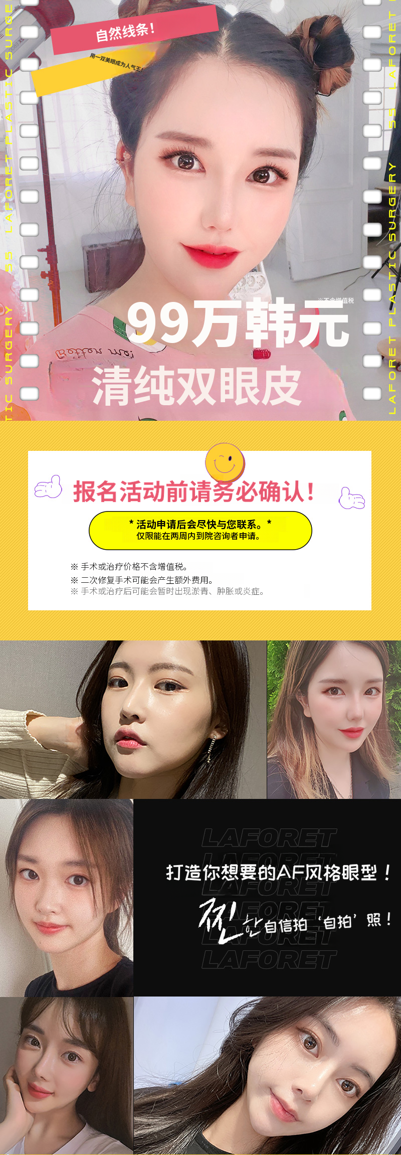 自然线条!清纯双眼皮