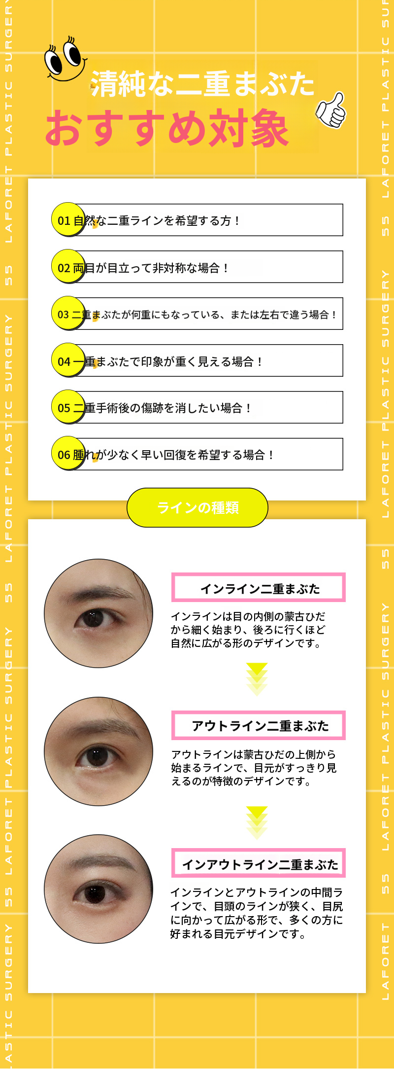 自然なライン! 清純二重まぶた