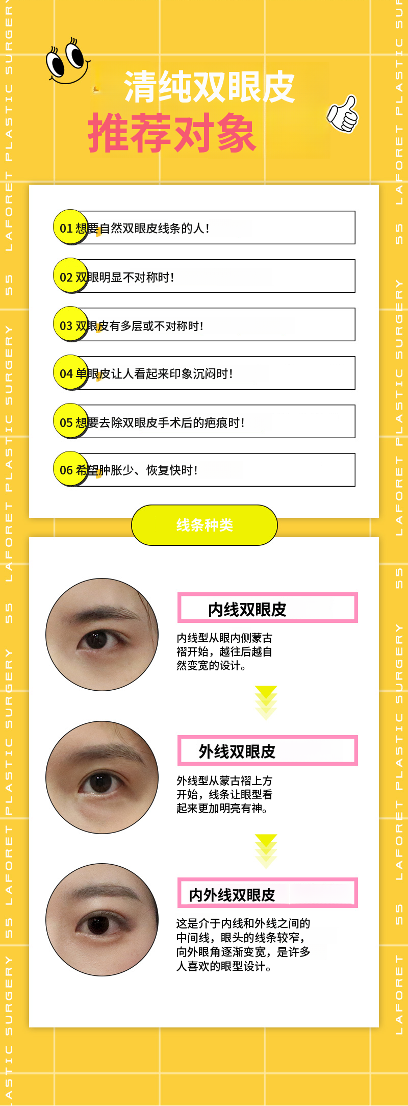 自然线条!清纯双眼皮