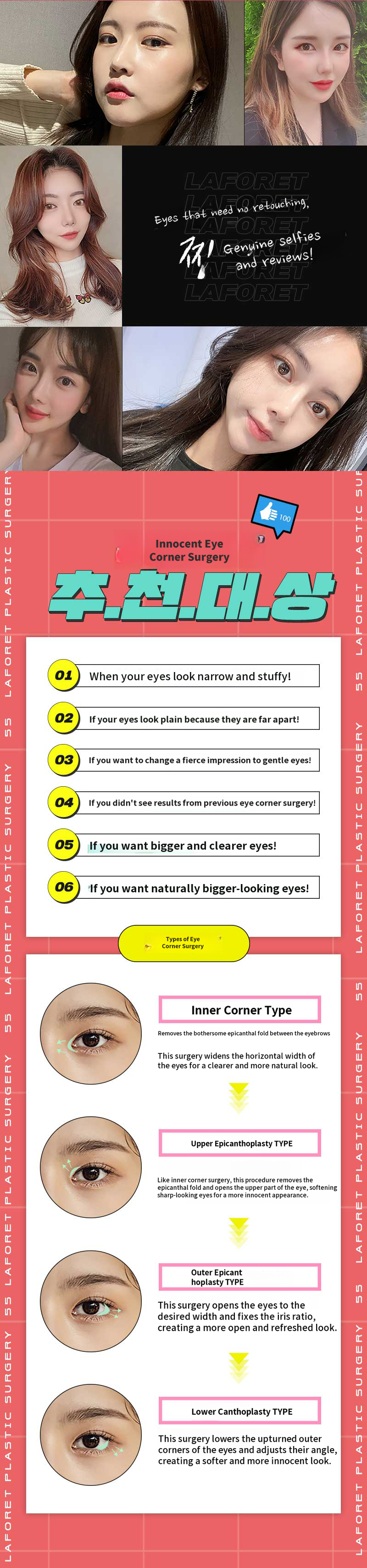 A natural look! Pure double eyelid