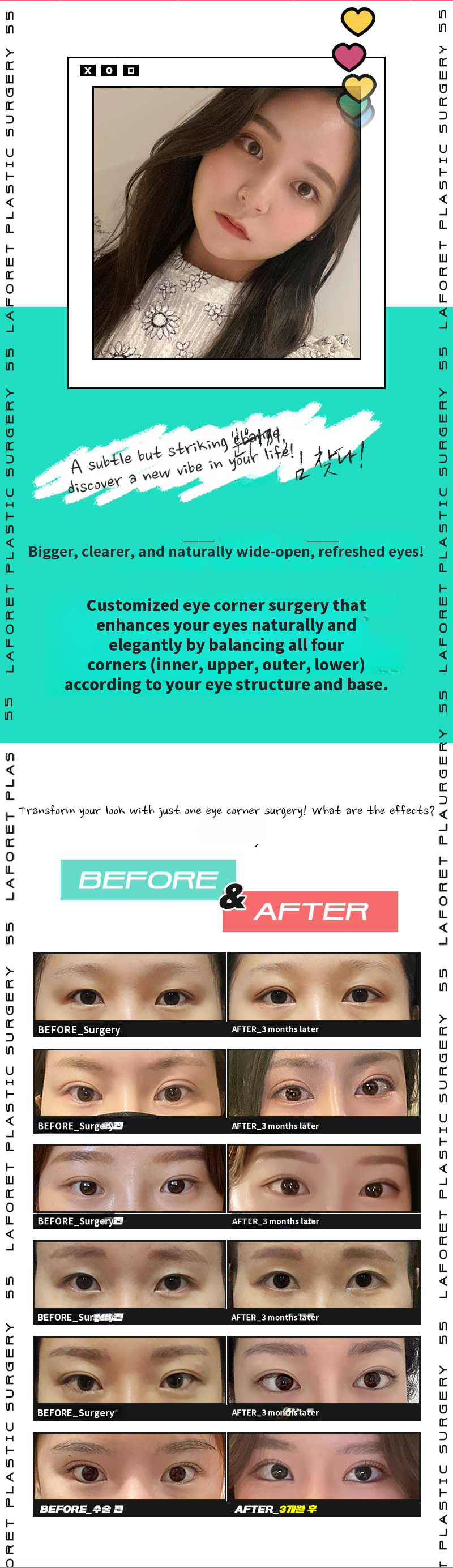 A natural look! Pure double eyelid