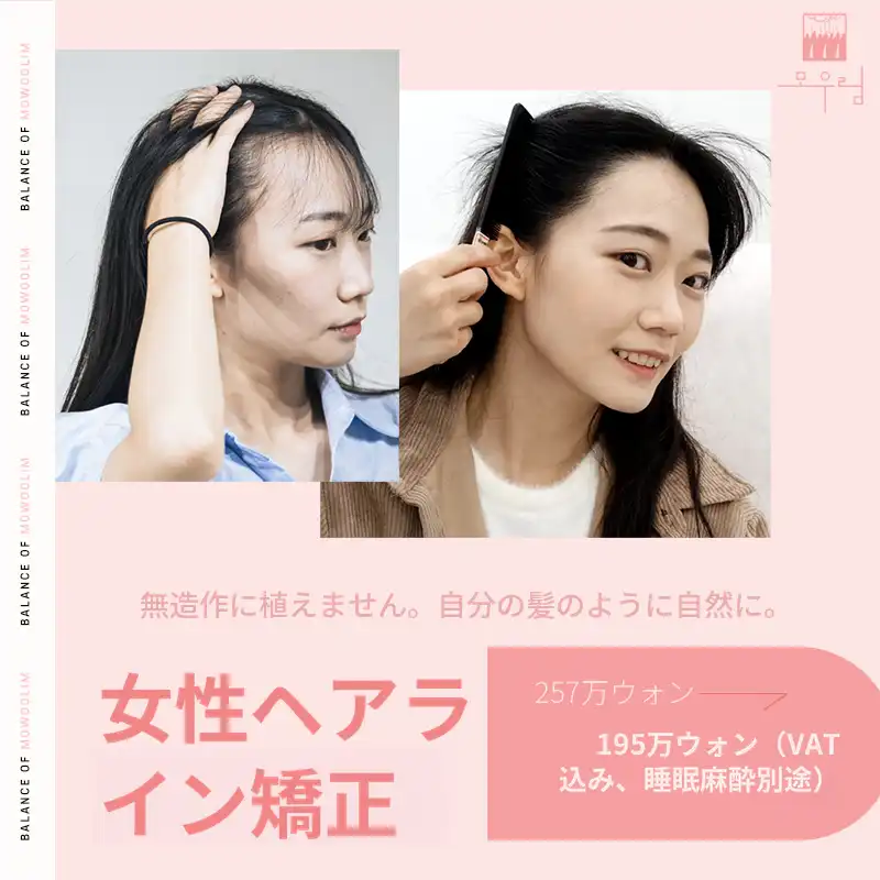 顔小顔 女性ヘアライン毛髪移植