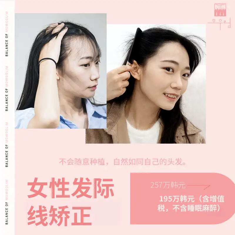 面部缩小女性发际线植发