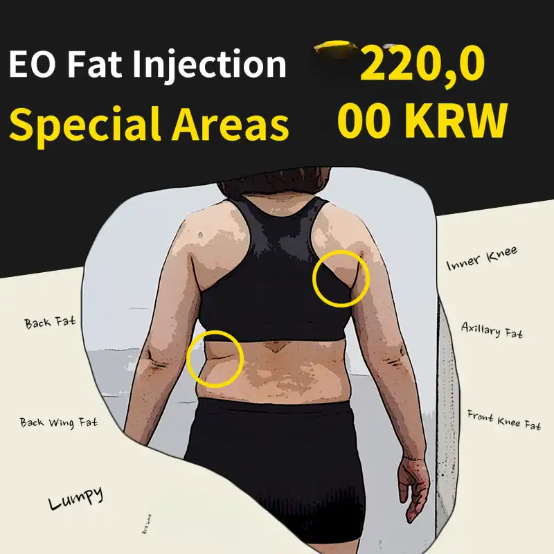 Special area fat-dissolving Eofat injection