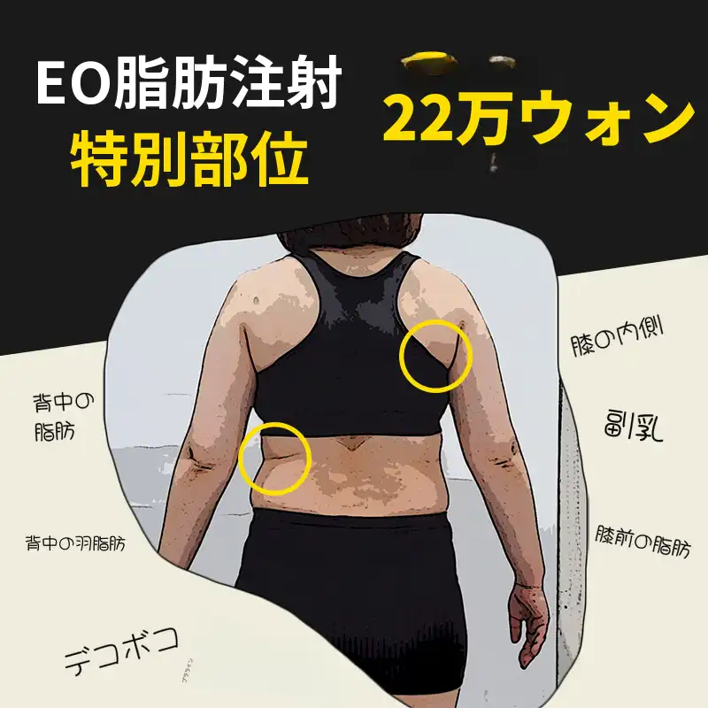 特殊部位脂肪分解イオファット注射