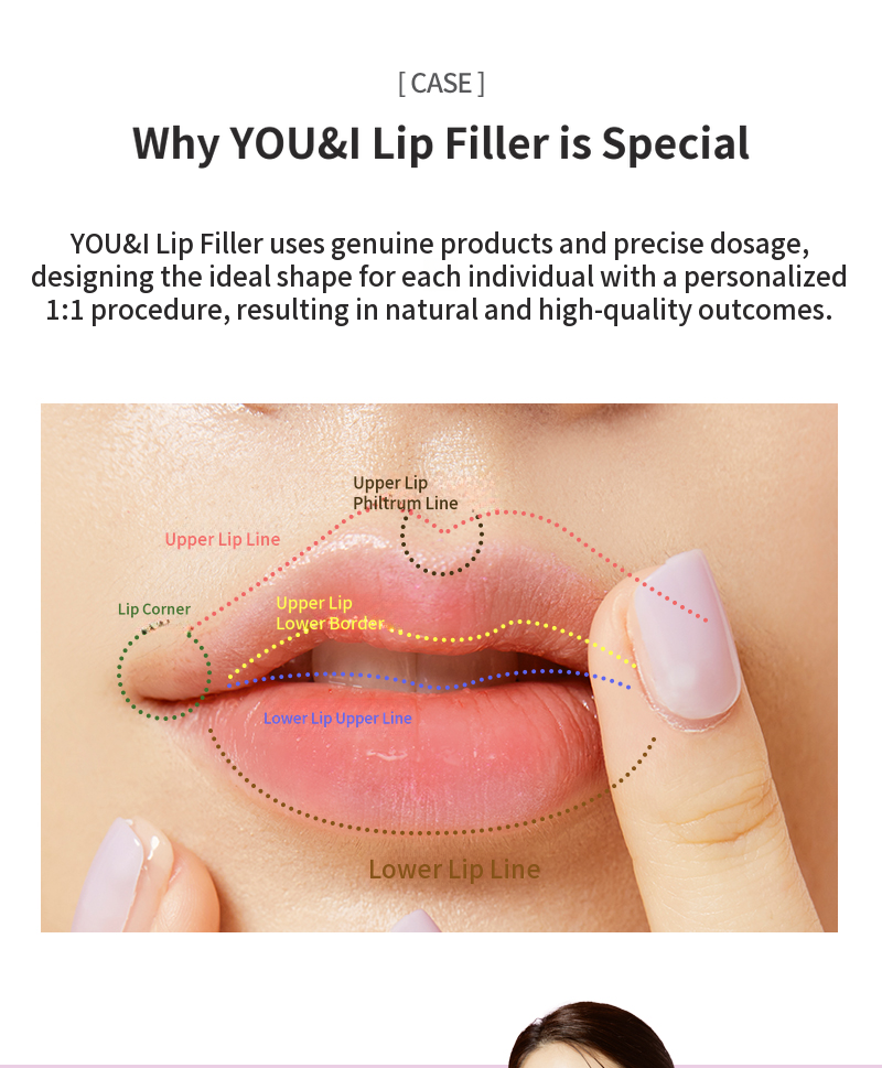 Ilsan) Firm volume filler