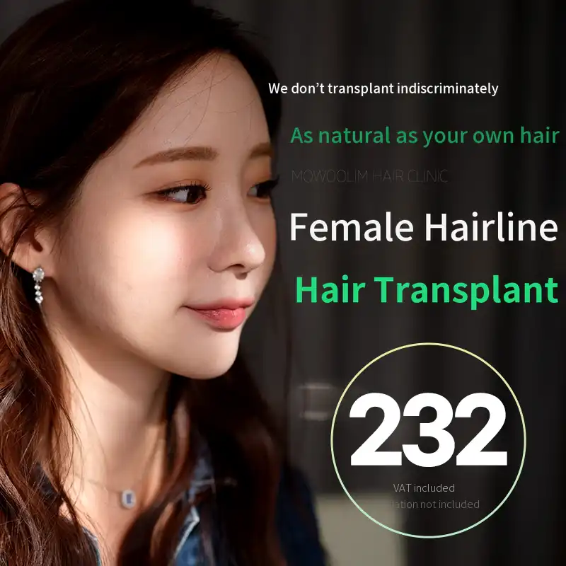 Non-surgical hairline transplant for women